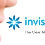 How Long Does Treatment With Invisalign Typically Take?