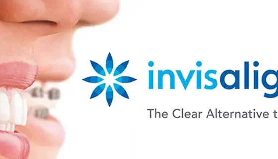 How Long Does Treatment With Invisalign Typically Take?